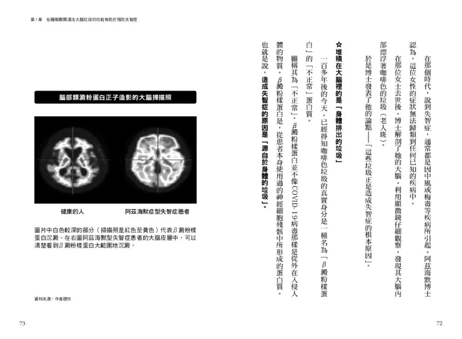 别再欠下睡眠债！清理脑内垃圾的「熟睡习惯」